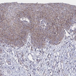 PEX14 Antibody, Novus Biologicals 0.1mL; Unlabeled:Antibodies, Polyclonal
